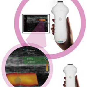 Sonda wireless per medicina estetica - Ultralift HF -